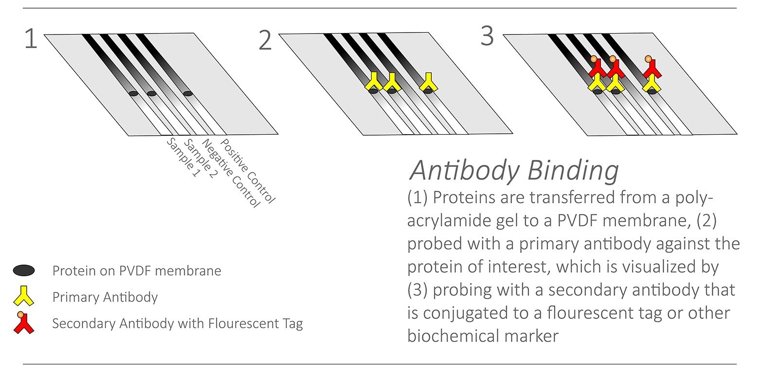 Western Blot Overview